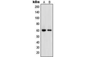 Western blot analysis of DNA Polymerase epsilon 2 expression in HL60 (A), HeLa (B) whole cell lysates. (POLE2 anticorps  (Center))