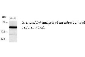 Image no. 2 for anti-Solute Carrier Family 17 (Vesicular Glutamate Transporter), Member 6 (SLC17A6) (C-Term) antibody (ABIN346995)