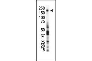Western blot analysis of anti-RON Pab (ABIN392048 and ABIN2841815) in THP1 cell lysate.