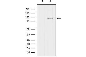 anti-CCR4-NOT Transcription Complex, Subunit 10 (CNOT10) (Internal Region) antibody
