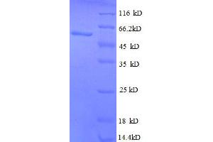 Activated Leukocyte Cell Adhesion Molecule (ALCAM) (AA 28-516), (partial) protein (His tag) (CD166 Protein (AA 28-516, partial) (His tag))