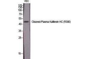 Western Blot (WB) analysis of specific cells using Cleaved-Plasma Kallikrein HC (R390) Polyclonal Antibody. (Plasma Kallikrein HC (Arg390), (cleaved) anticorps)