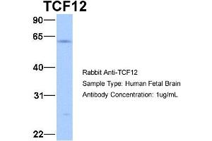 Host:  Rabbit  Target Name:  TCF12  Sample Type:  Human Fetal Brain  Antibody Dilution:  1. (TCF12 anticorps  (N-Term))