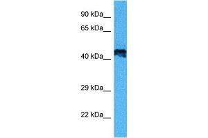 Host:  Mouse  Target Name:  E2F2  Sample Tissue:  Mouse Heart  Antibody Dilution:  1ug/ml (E2F2 anticorps  (Middle Region))