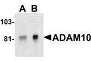 Western Blotting (WB) image for anti-ADAM Metallopeptidase Domain 10 (ADAM10) antibody (ABIN2478644) (ADAM10 anticorps)