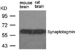 Image no. 2 for anti-Synaptotagmin I (SYT1) (Ser309) antibody (ABIN401634) (SYT1 anticorps  (Ser309))