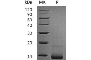 Western Blotting (WB) image for Chemokine (C-C Motif) Ligand 5 (CCL5) protein (His tag) (ABIN7321250) (CCL5 Protein (His tag))