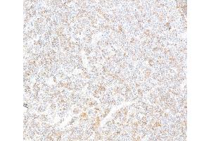 Immunohistochemistry (IHC) image for anti-REL proto-oncogene (c-Rel) (C-Term) antibody (ABIN7795772)