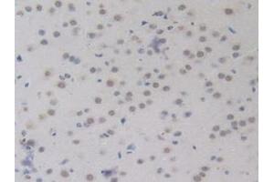 Detection of BMP15 in Mouse Brain Tissue using Polyclonal Antibody to Bone Morphogenetic Protein 15 (BMP15)