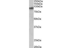 ZNF652 anticorps  (AA 594-606)