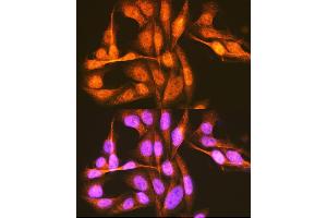 Immunofluorescence analysis of U-2 OS cells using hnRNP E1/hnRNP E1/PCBP1 Rabbit pAb (ABIN6134408, ABIN6145277, ABIN6145278 and ABIN6214692) at dilution of 1:100 (40x lens). (PCBP1 anticorps  (AA 100-200))