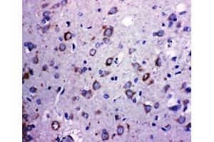 IHC-P: TRPC6 antibody testing of rat brain tissue (TRPC6 anticorps  (Middle Region))