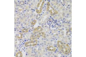 Immunohistochemistry of paraffin-embedded mouse kidney using TSC22D3 Antibody. (TSC22D3 anticorps  (AA 1-79))
