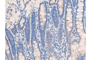 ABIN6267253 at 1/100 staining rat colon tissue sections by IHC-P.