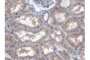 DAB staining on IHC-P; Samples: Human Kidney Tissue (PTTG1IP anticorps  (AA 33-96))