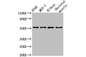 Western Blot Positive WB detected in: A549 whole cell lysate, MCF-7 whole cell lysate, Mouse kidney tissue, Mouse skeletal muscle tissue All lanes: NARF antibody at 3 μg/mL Secondary Goat polyclonal to rabbit IgG at 1/50000 dilution Predicted band size: 52, 57, 46, 45 kDa Observed band size: 52 kDa (NARF anticorps  (AA 10-41))