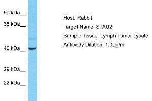 Host: Rabbit Target Name: STAU2 Sample Tissue: Human Lymph Tumor Antibody Dilution: 1ug/ml (Double-stranded RNA-binding protein Staufen homolog 2 (STAU2) (C-Term) anticorps)