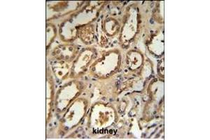DCP2 Antibody (Center) (ABIN653129 and ABIN2842708) IHC analysis in formalin fixed and paraffin embedded human kidney tissue followed by peroxidase conjugation of the secondary antibody and DAB staining. (DCP2 anticorps  (AA 144-173))