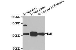 Western blot analysis of extracts of various tissues, using IDE antibody. (IDE anticorps)