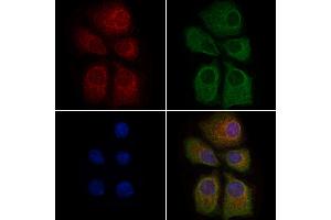 ABIN6263370 and ABIN6279022 staining HepG2 cells by IF/ICC. (MRPL37 anticorps  (N-Term))