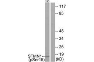 Western blot analysis of extracts from 293 cells, using Stathmin 1 (Phospho-Ser15) Antibody. (Stathmin 1 anticorps  (pSer16))