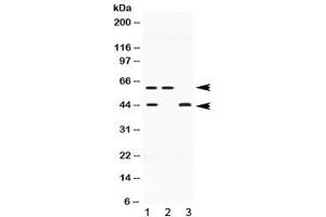 Western blot testing of human 1) HeLa, 2) U-2 OS and 3) MCF7 lysate with E2F4 antibody at 0. (E2F4 anticorps  (AA 106-144))