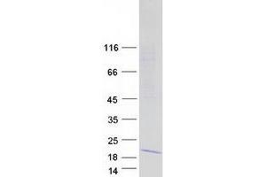 Validation with Western Blot