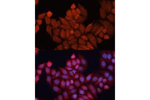 Immunofluorescence analysis of HeLa cells using DN antibody (ABIN6130336, ABIN6139701, ABIN6139702 and ABIN7101774) at dilution of 1:100.