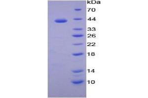 SDS-PAGE of Protein Standard from the Kit  (Highly purified E. (Transferrin Receptor 2 Kit ELISA)