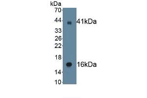 Detection of Recombinant SCNN1g, Human using Monoclonal Antibody to Amiloride Sensitive Sodium Channel Subunit Gamma (SCNN1g)