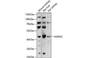 Western blot analysis of extracts of various cell lines, using AADAC antibody (ABIN6129182, ABIN6136311, ABIN6136313 and ABIN6218113) at 1:1000 dilution. (AADAC anticorps  (AA 170-399))