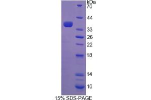 Image no. 1 for Protocadherin gamma Subfamily A, 2 (PCDHGA2) (AA 29-347) protein (His tag) (ABIN6237022) (PCDHGA2 Protein (AA 29-347) (His tag))