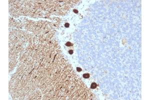 Formalin-fixed, paraffin-embedded human Cerebellum stained with CA8 Mouse Monoclonal Antibody (CPTC-CA8-2). (CA8 anticorps)