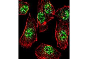 Immunofluorescence (IF) image for anti-Rhox Homeobox Family, Member 2B (RHOXF2B) antibody (ABIN3000753) (RHOXF2B anticorps)