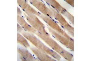 Formalin fixed, paraffin embedded human skeletal muscle stained with RHEB Antibody (C-term) followed by peroxidase conjugation of the secondary antibody and DAB staining. (RHEB anticorps  (C-Term))