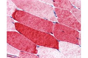 Anti-RPTOR / Raptor antibody IHC of human skeletal muscle.