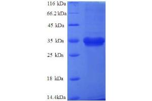 SDS-PAGE (SDS) image for Six Transmembrane Epithelial Antigen of The Prostate 1 (STEAP1) (AA 3-69), (partial) protein (GST tag) (ABIN5712852)
