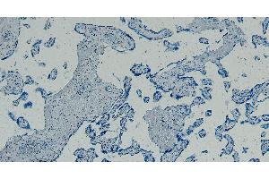 ABIN334408 Negative Control showing staining of paraffin embedded Human Placenta, with no primary antibody. (GBX2 anticorps  (Internal Region))