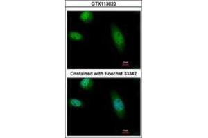 Image no. 3 for anti-RAD23 Homolog B (RAD23B) (AA 164-409) antibody (ABIN1500578)