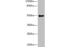 Western blot All lanes: GSDMB antibody at 8 μg/mL + Colo320 whole cell lysate Secondary Goat polyclonal to rabbit IgG at 1/10000 dilution Predicted band size: 47, 46, 48, 19 kDa Observed band size: 47 kDa (Gasdermin B anticorps  (AA 63-310))