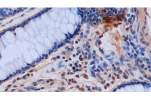 Detection of 5-HT in Porcine Colon Tissue using Polyclonal Antibody to 5-Hydroxytryptamine (5-HT) (Serotonin anticorps)