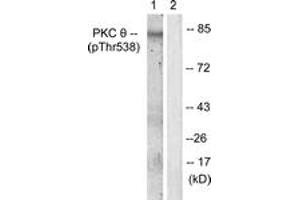 Western blot analysis of extracts from Jurkat cells, using PKC thet (Phospho-Thr538) Antibody. (PKC theta anticorps  (pThr538))