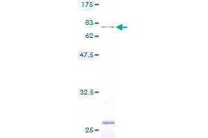 Image no. 1 for Leupaxin (LPXN) (AA 1-386) protein (GST tag) (ABIN1309707)