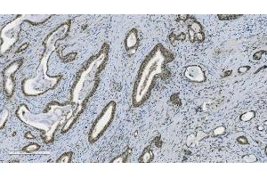 IHC analysis of PARP using anti-PARP antibody (ABIN7602278). (PARP1 anticorps  (AA 670-858))