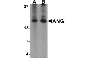 Western blot analysis of ANG in rat liver tissue lysate with Ang antibody at (A) 1 and (B) 2 µg/mL. (ANG anticorps  (Middle Region))