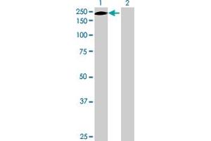 Western Blot analysis of ERCC5 expression in transfected 293T cell line by ERCC5 MaxPab polyclonal antibody. (ERCC5 anticorps  (AA 1-1186))
