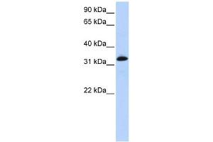 Troponin T Type 2 antibody used at 1 ug/ml to detect target protein. (Cardiac Troponin T2 anticorps)