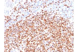 Formalin-fixed, paraffin-embedded human Lymph Node stained with Oct-2 Mouse Monoclonal Antibody (OCT2/2137).