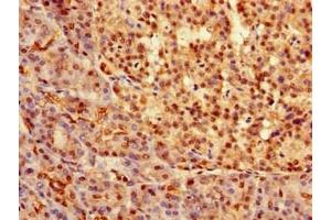 Immunohistochemistry of paraffin-embedded human pancreatic tissue using ABIN7172642 at dilution of 1:100