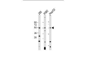 All lanes : Anti-VEGFC Antibody at 1:2000 dilution Lane 1: 293 whole cell lysate Lane 2: K562 whole cell lysate Lane 3: HepG2 whole cell lysate Lysates/proteins at 20 μg per lane. (VEGFC anticorps)